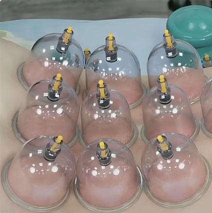 [Александр Сокун] [ККПК] Вакуумно-баночная терапия_0.png